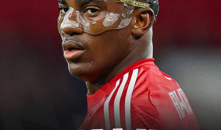 Breaking News: Forest Forward Taiwo Awoniyi in Induced Coma After Urgent Surgery – Fighting Back with Resilience 2